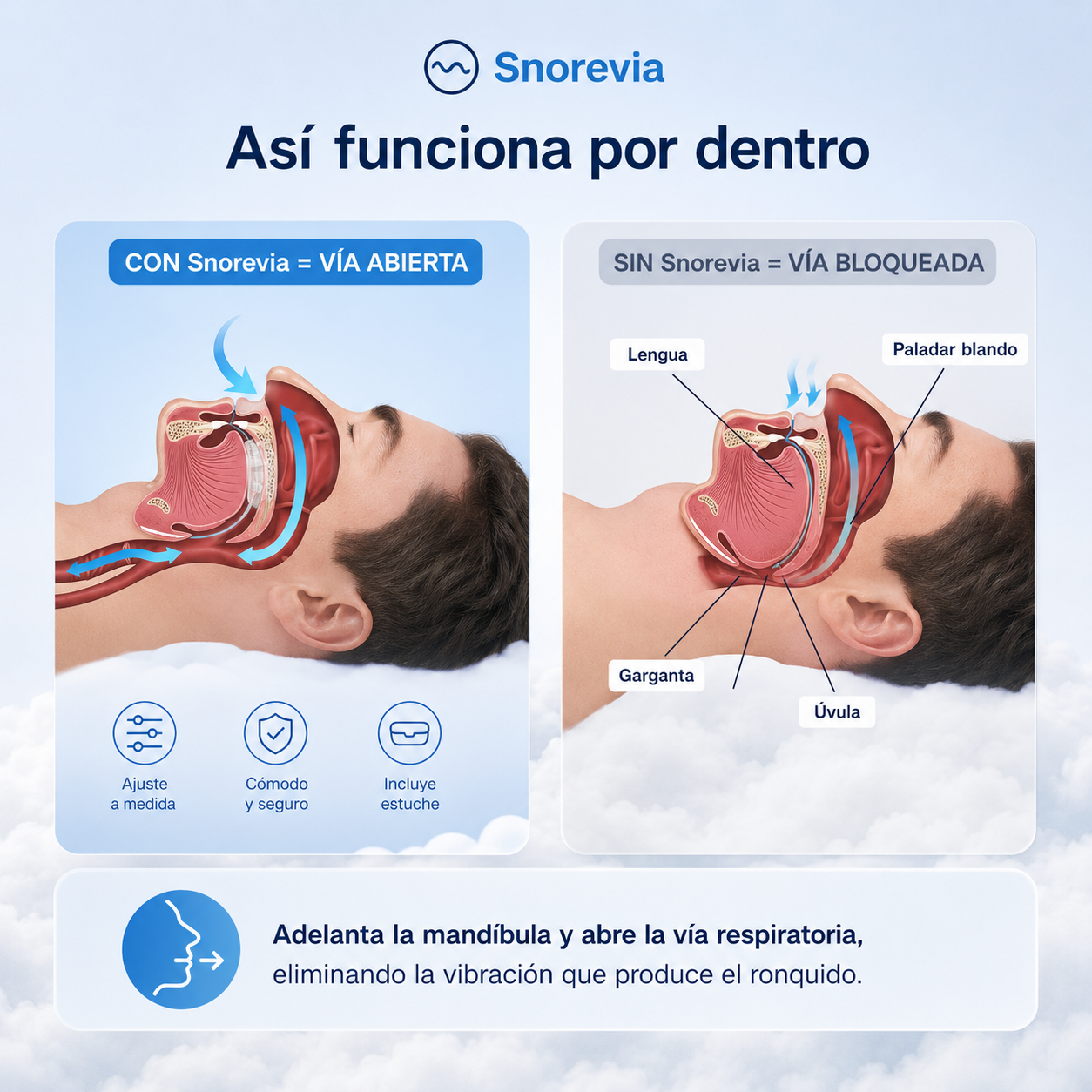 Snorevia® — Boquilla Antirronquidos